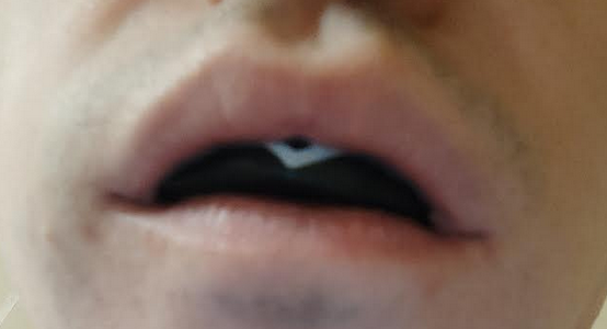 554x300