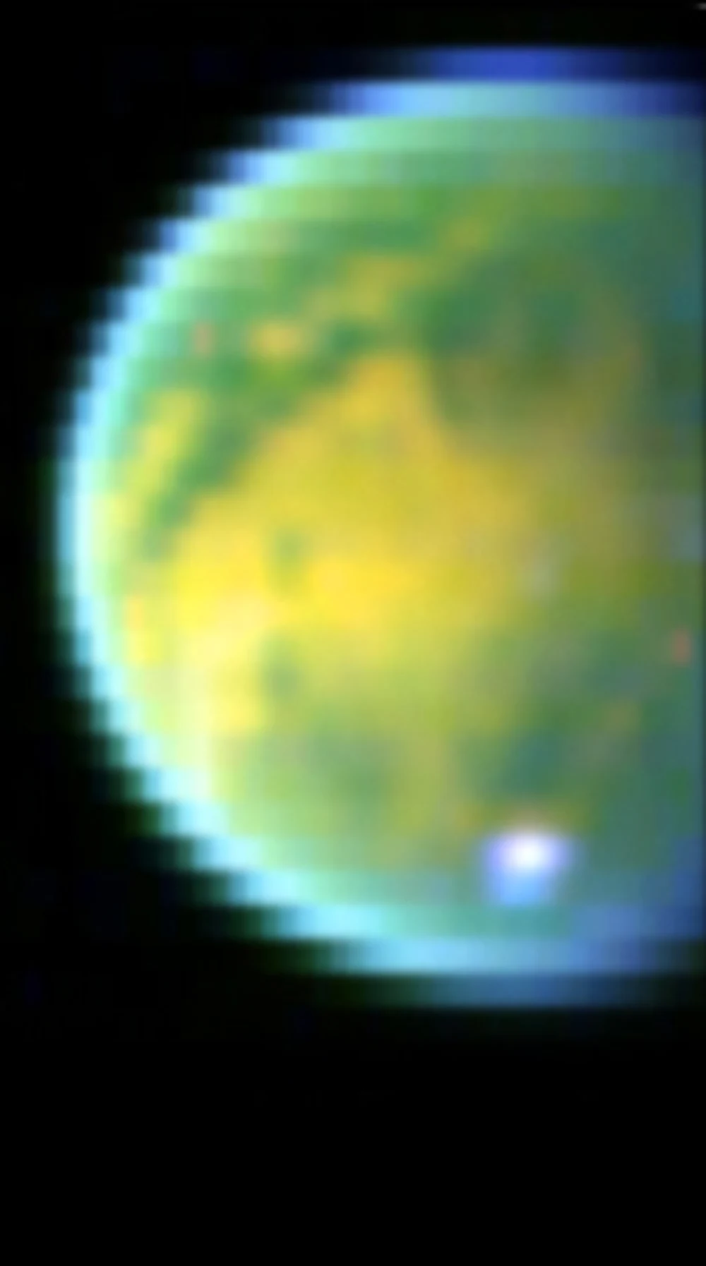 1000x1794